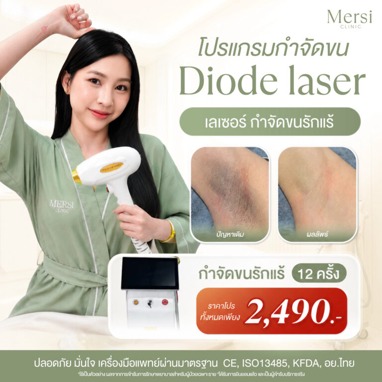 โปรโมชั่น โปรแกรม Diode Laser กำจัดขนรักแร้ 12 ครั้ง 2,490 บาท