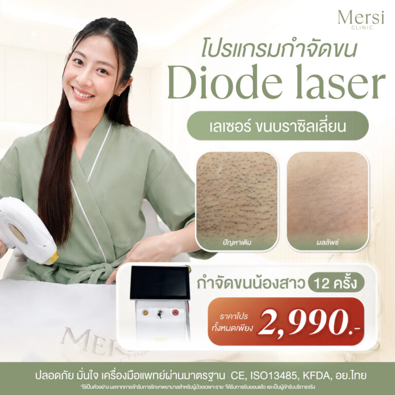 โปรโมชั่น โปรแกรม Diode Laser กำจัดขนน้องสาว 12 ครั้ง 2,990 บาท