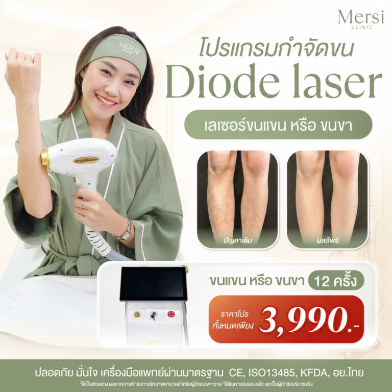 โปรโมชั่น โปรแกรม Diode Laser กำจัดขนแขน หรือขนขา 12 ครั้ง 3,990 บาท
